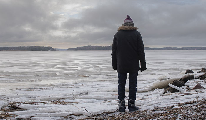 Fyysinen toipuminen vaikeasta palovammasta on pitkä ja kivulias tie
